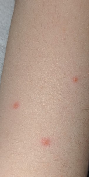 To ask what these lumps look like to you?