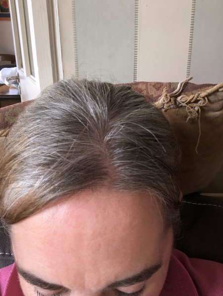 Should I just seize the opportunity to go grey?