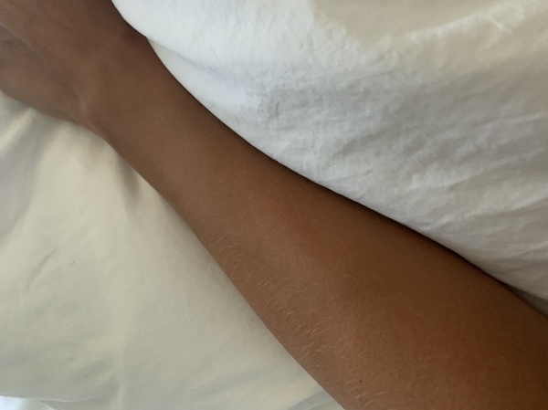 Son's girlfriend thinks suntans are racist