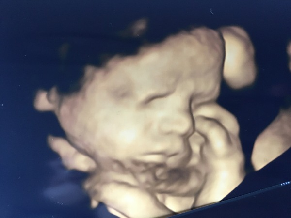 Pregnant after Loss and Dreaming of Rainbows - 5