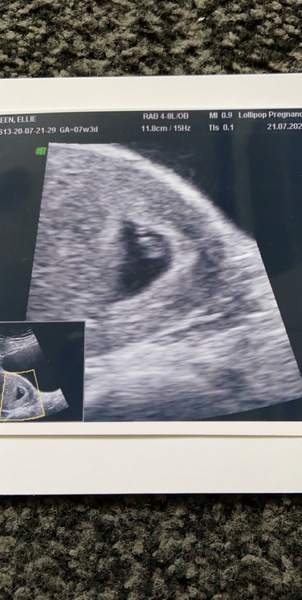 March 2021 babies