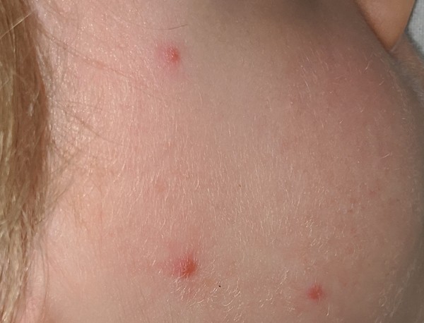 To ask what these lumps look like to you?
