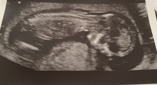 January 2021 mums to be