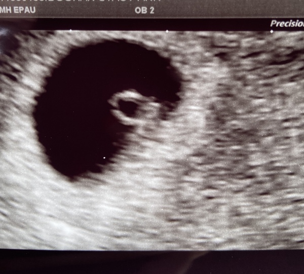 March 2021 babies