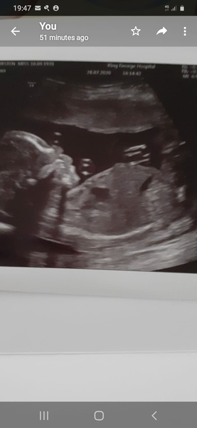 👣 Due Nov/Dec 👣 it's the 20 week scans! 👣