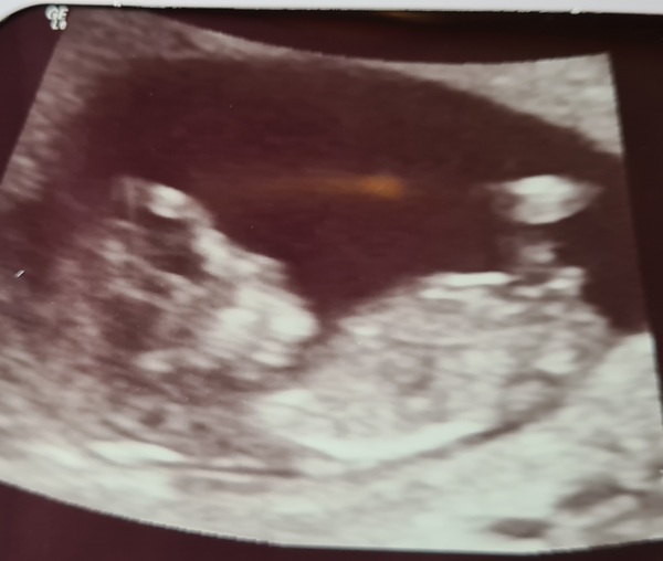 Boy or girl 12 weeks 1 day