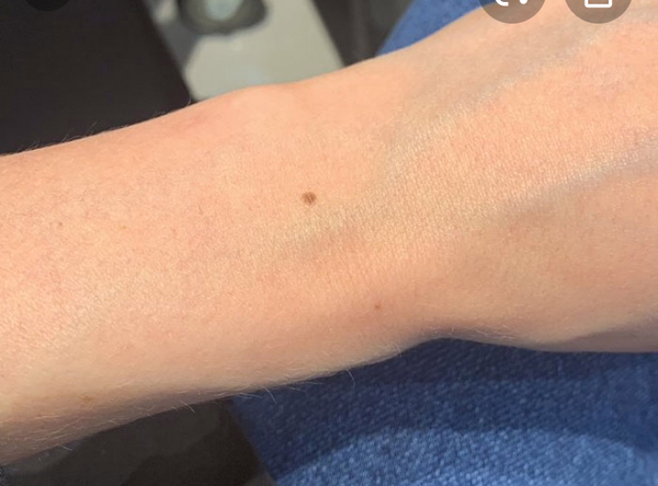 Do you have a mole under your left boob?