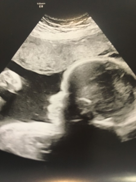 Pregnant After Loss and Dreaming of Rainbows - 4