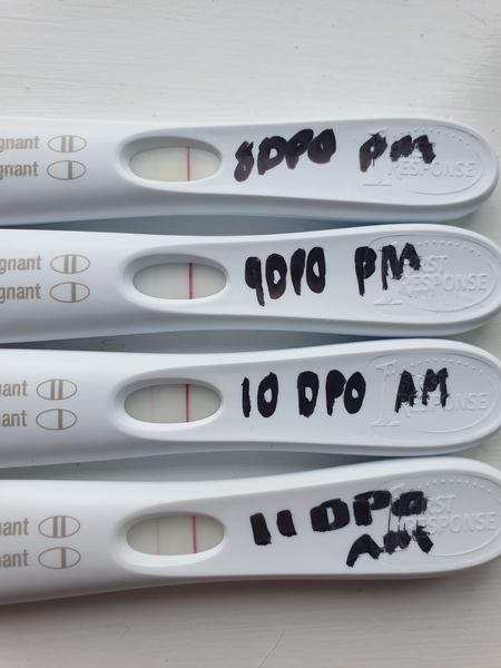 Pregnant after Missed Miscarriage MMC