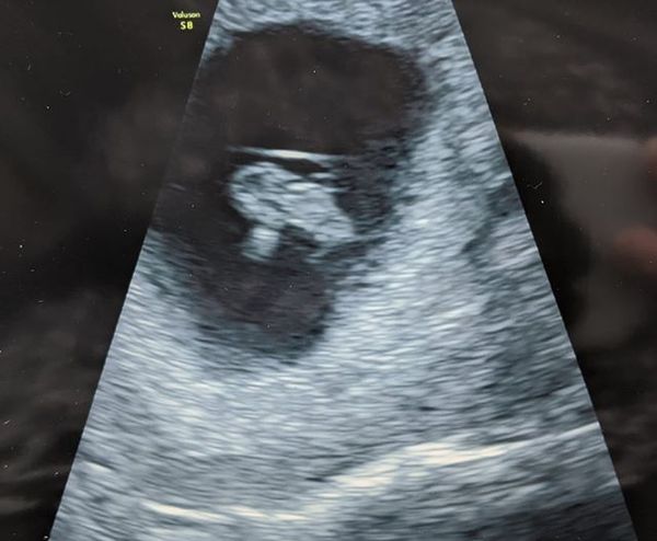 Due February 2021