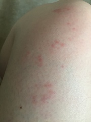 Anyone know what this is on my leg?!