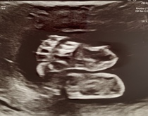 👣 Due Nov/Dec 👣 it's the 20 week scans! 👣