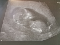 Gender Guess