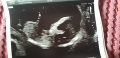 Fun gender guess ❤