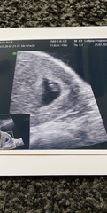 March 2021 babies