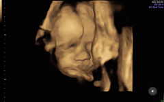 Catching up - TTC after miscarriage part 2