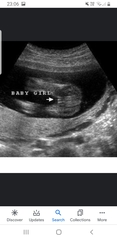 Thread 2 for us classed as more mature pregnant ladies