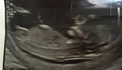 13+1 Gestation, give me your guesses 😆
