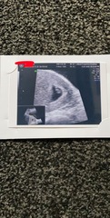 March 2021 babies