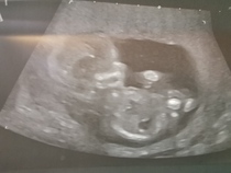 Gender Guess