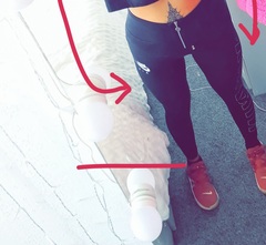 Weird fat deposit?