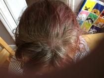 Hair colour advice requested please. Photo included.