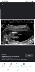 Thread 2 for us classed as more mature pregnant ladies