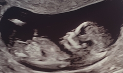 Can they really tell the gender at 14 weeks?