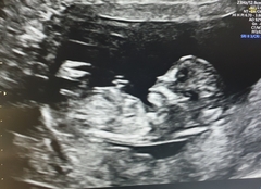 Gender Predictions from Scan today