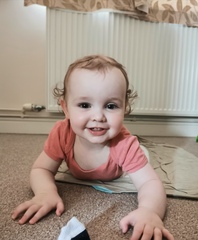 Toddler eyelid drooping/one eye bigger than the other. Should I be worried?