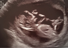 13+1 Gestation, give me your guesses 😆