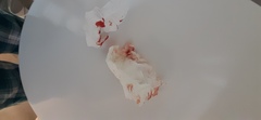 Help. Bleeding