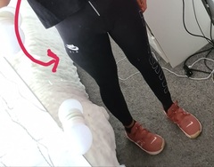 Weird fat deposit?