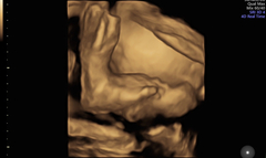 Catching up - TTC after miscarriage part 2