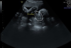 Can they really tell the gender at 14 weeks?