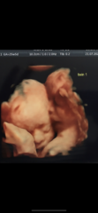 Late October Thread - 4