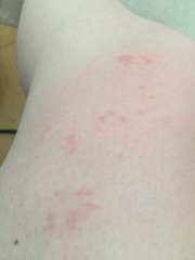 Anyone know what this is on my leg?!
