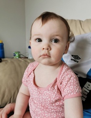 Toddler eyelid drooping/one eye bigger than the other. Should I be worried?