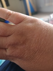 Why are my hands ageing so quickly?