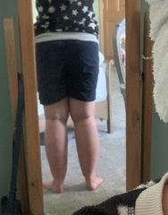 Can any one please advise on cankles :(