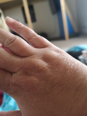 Why are my hands ageing so quickly?