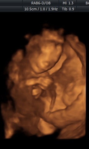 January 2021 due date bus 4