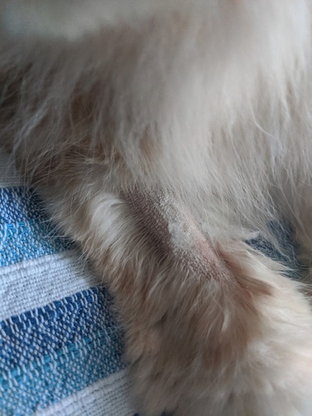 Removing bandage after drip