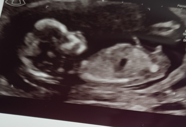Any gender guesses