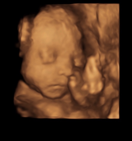 Due end Nov/early Dec - Hello third trimester!