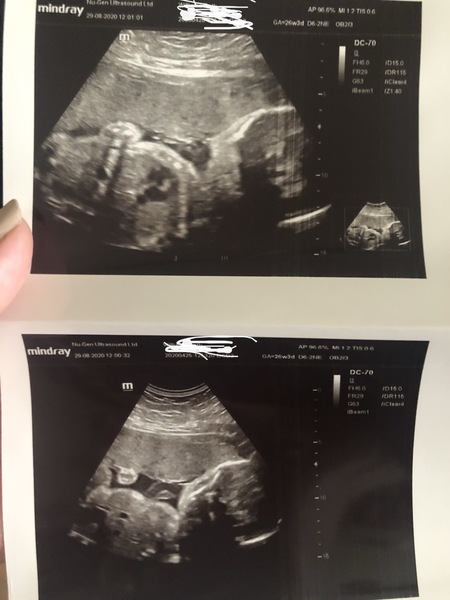 Guess the gender