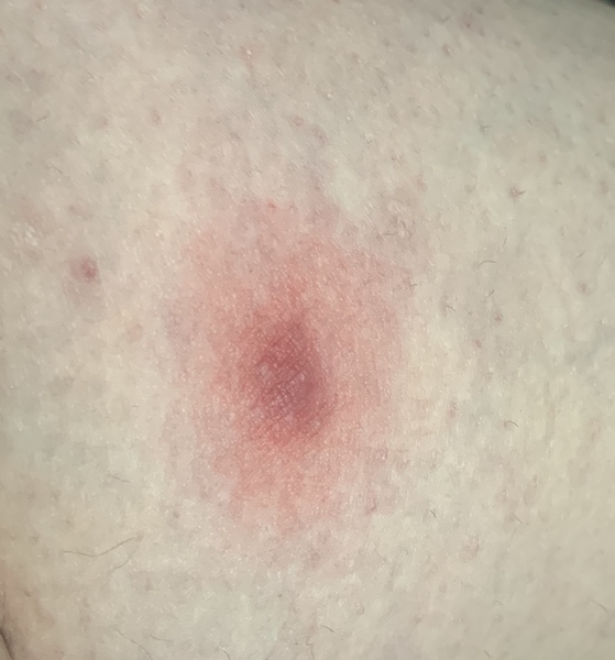 Any ideas what this could be?!