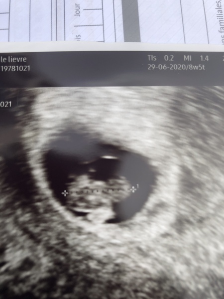 Old ovaries, new lines