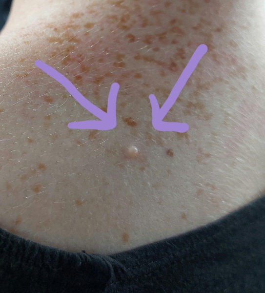 What is this lumpy spot..?