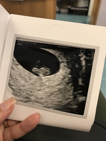BFP through IVF. Thread to calm the nerves!